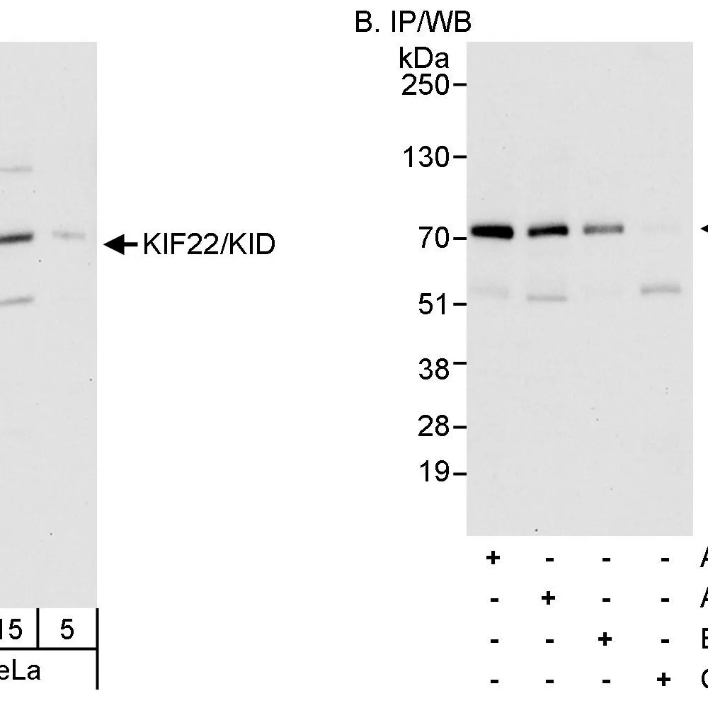 Rabbit anti-KIF22/KID Antibody, Affinity Purified