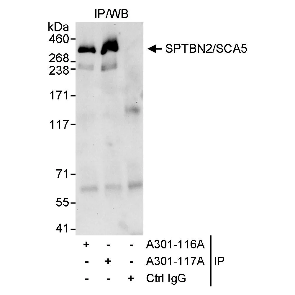 Rabbit anti-SPTBN2/SCA5 Antibody, Affinity Purified