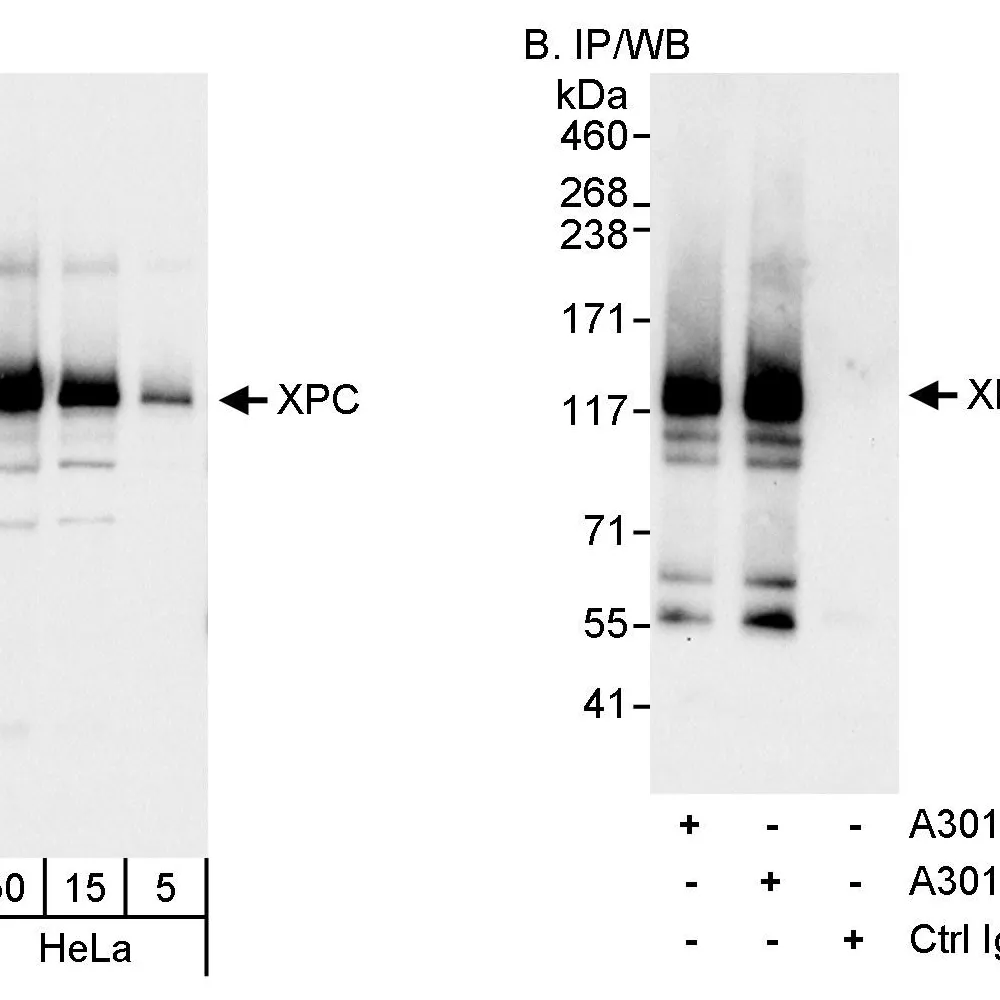 Rabbit anti-XPC Antibody, Affinity Purified