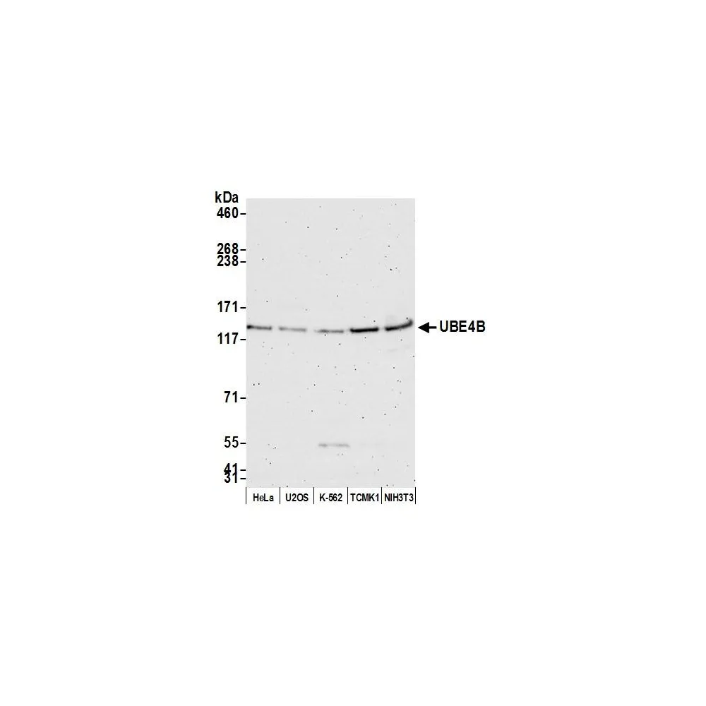 Rabbit anti-UBE4B Antibody, Affinity Purified