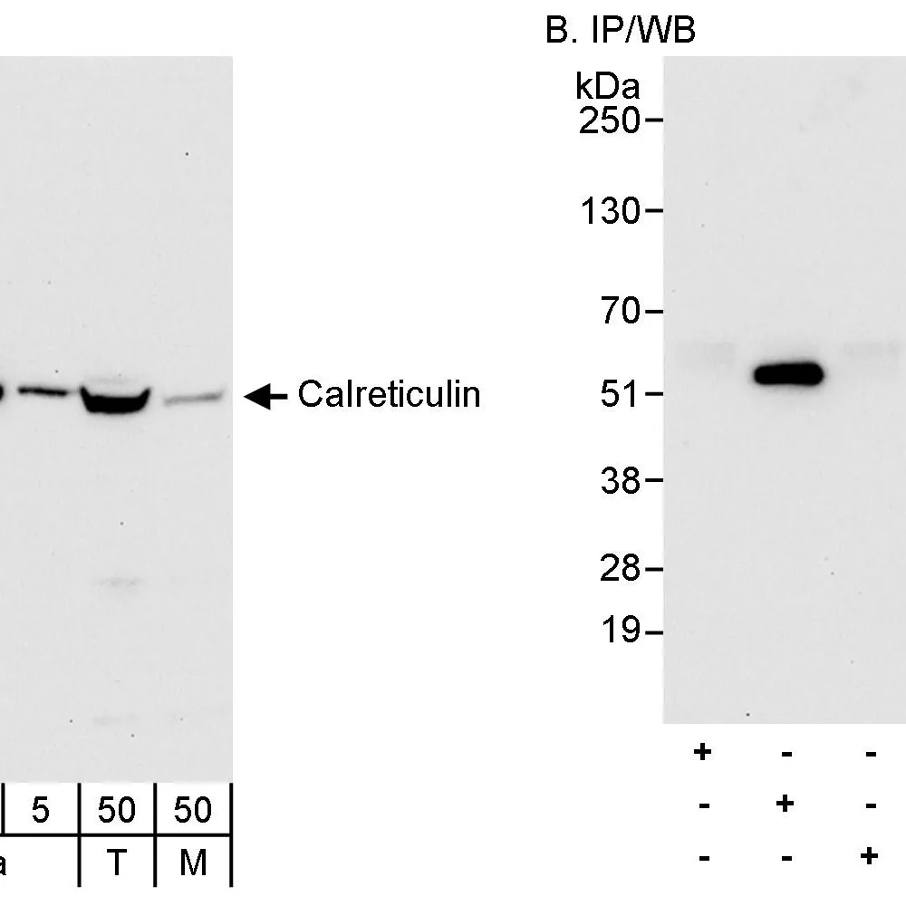 Rabbit anti-Calreticulin Antibody, Affinity Purified