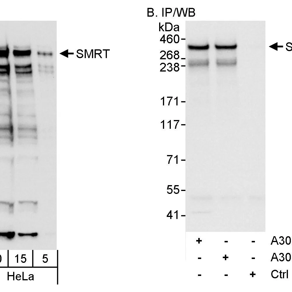 Rabbit anti-SMRT Antibody, Affinity Purified