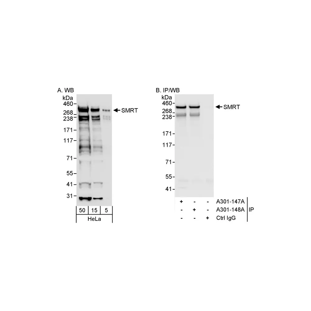 Rabbit anti-SMRT Antibody, Affinity Purified
