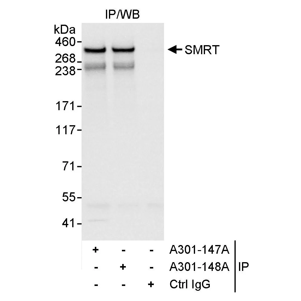 Rabbit anti-SMRT Antibody, Affinity Purified