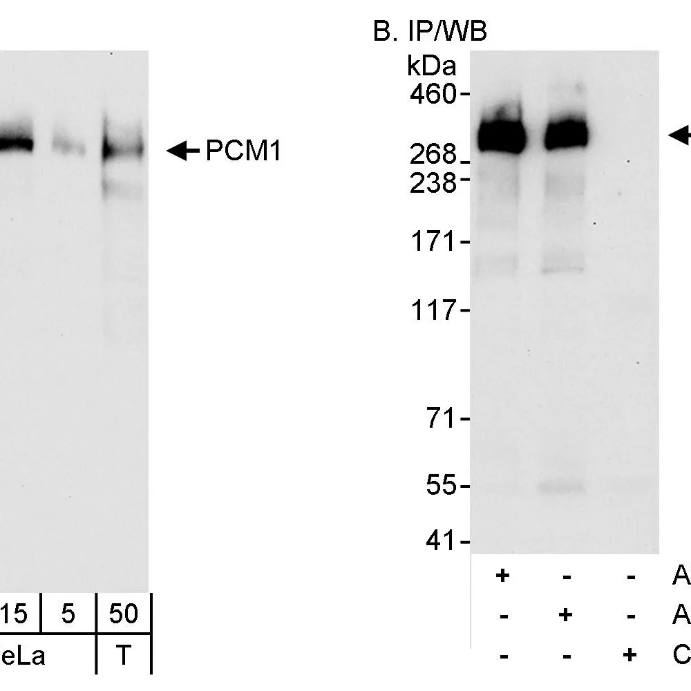 Rabbit anti-PCM1 Antibody, Affinity Purified