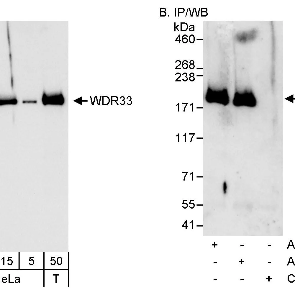 Rabbit anti-WDR33 Antibody, Affinity Purified