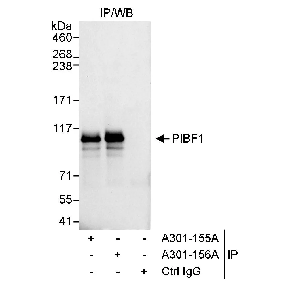 Rabbit anti-PIBF Antibody, Affinity Purified