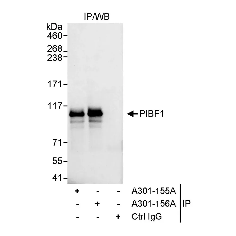 Rabbit anti-PIBF Antibody, Affinity Purified