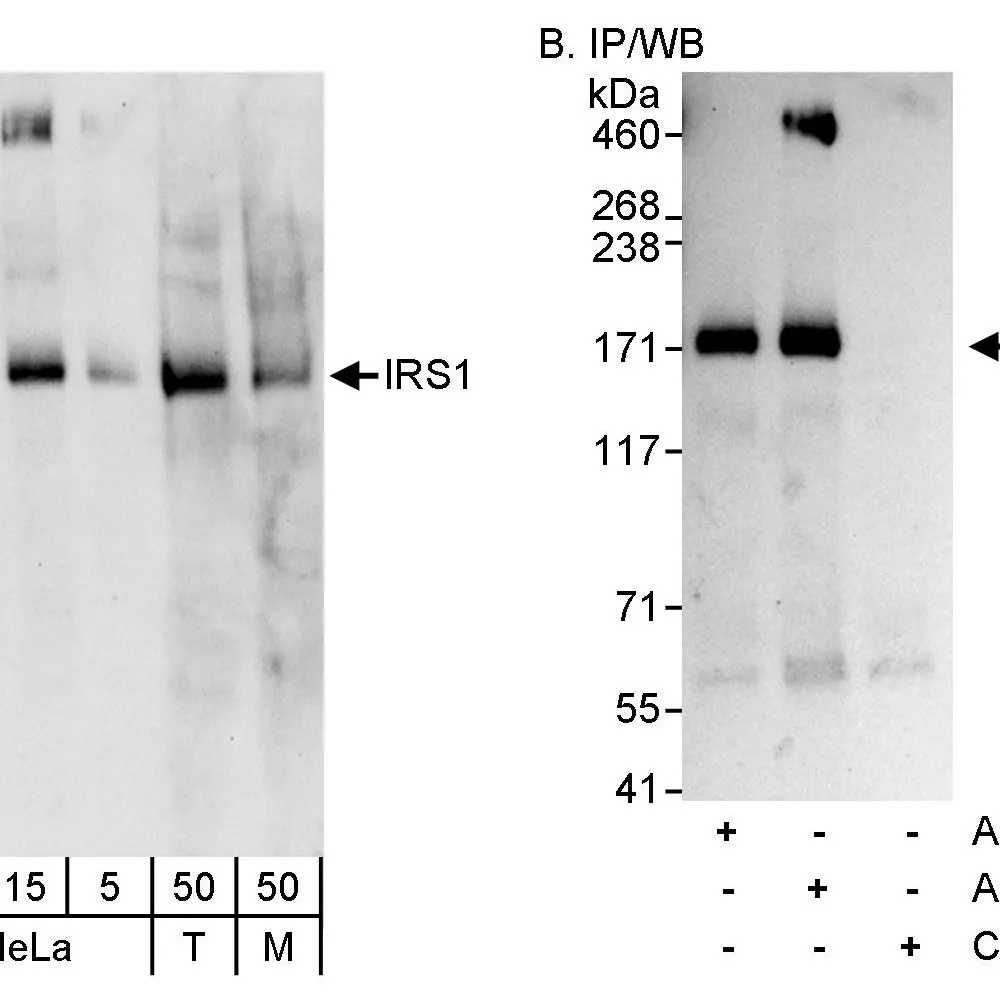 Rabbit anti-IRS1 Antibody, Affinity Purified