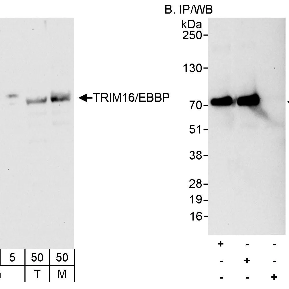 Rabbit anti-TRIM16/EBBP Antibody, Affinity Purified