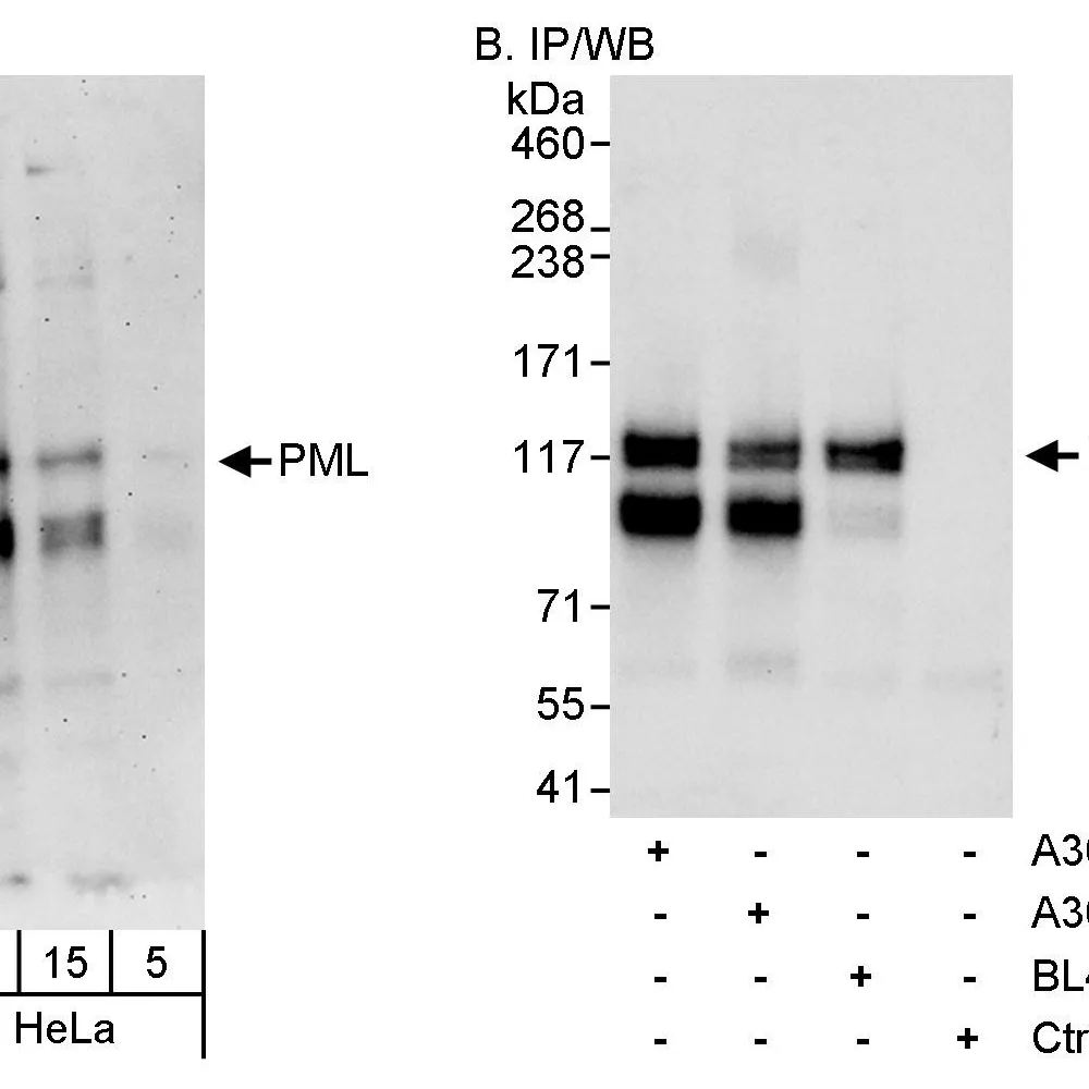 Rabbit anti-PML Antibody, Affinity Purified