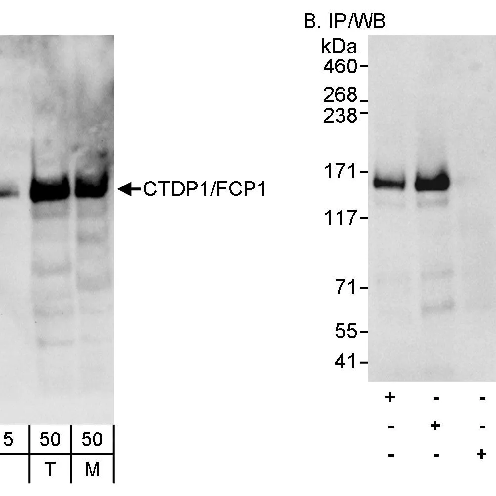 Rabbit anti-CTDP1/FCP1 Antibody, Affinity Purified