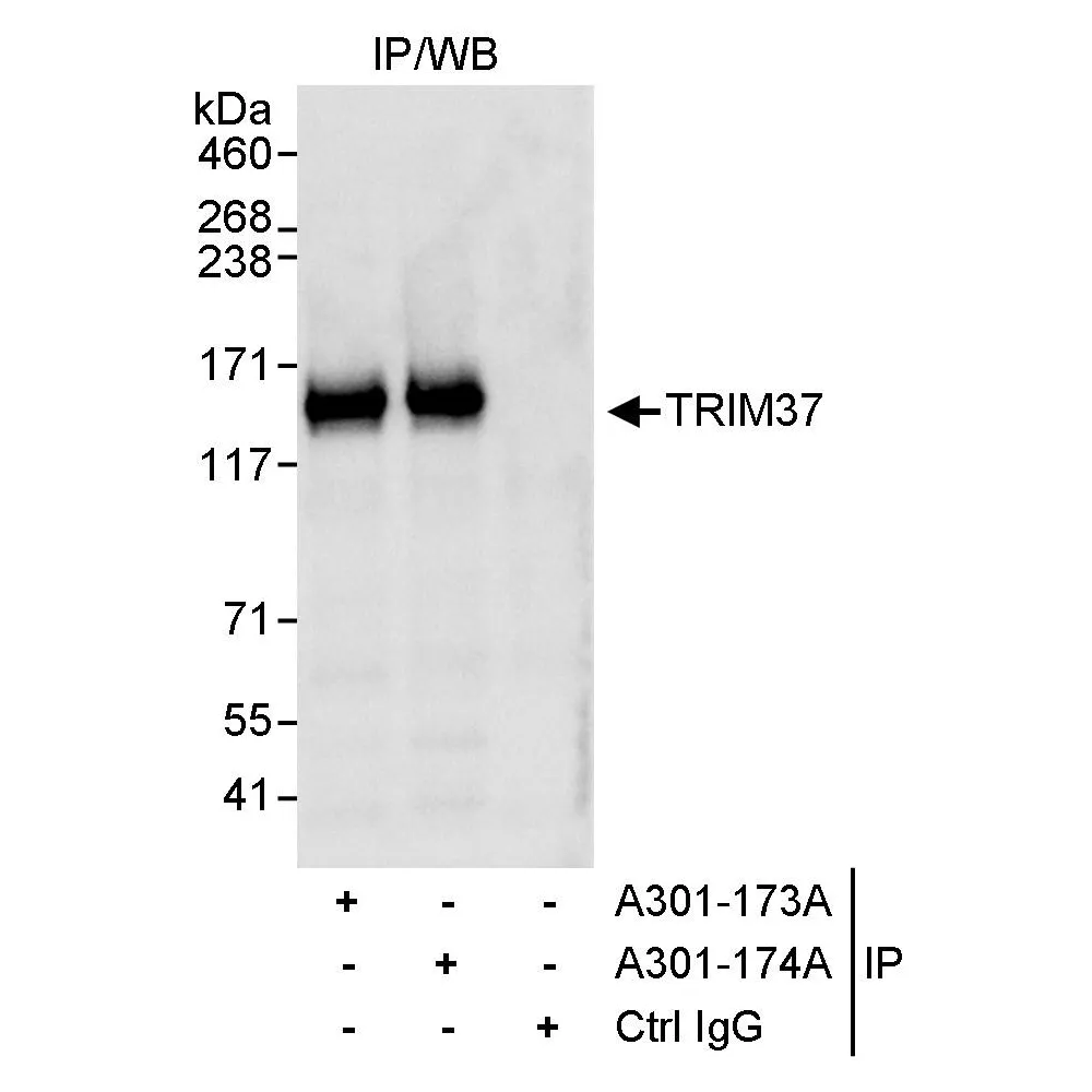 Rabbit anti-TRIM37 Antibody, Affinity Purified