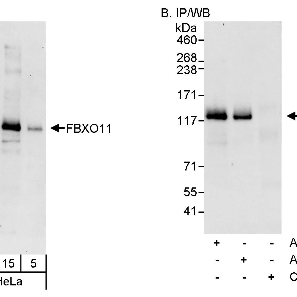 Rabbit anti-FBXO11 Antibody, Affinity Purified