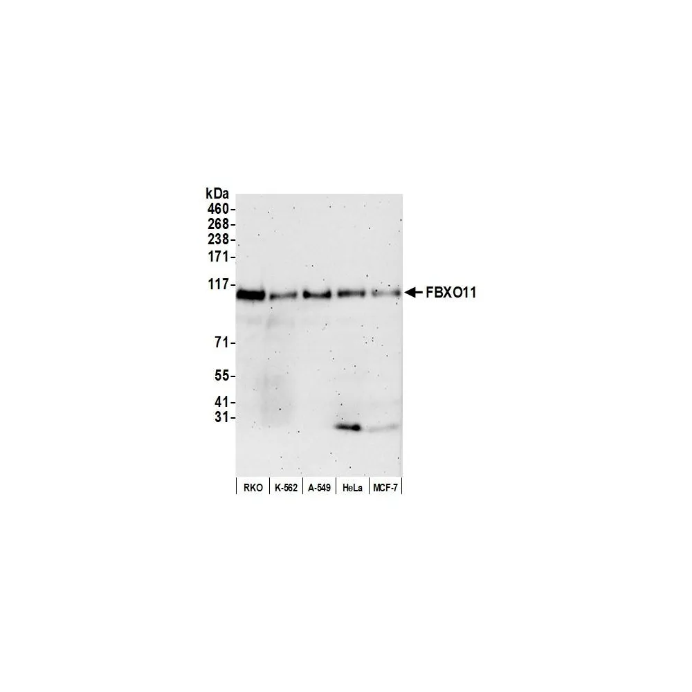 Rabbit anti-FBXO11 Antibody, Affinity Purified