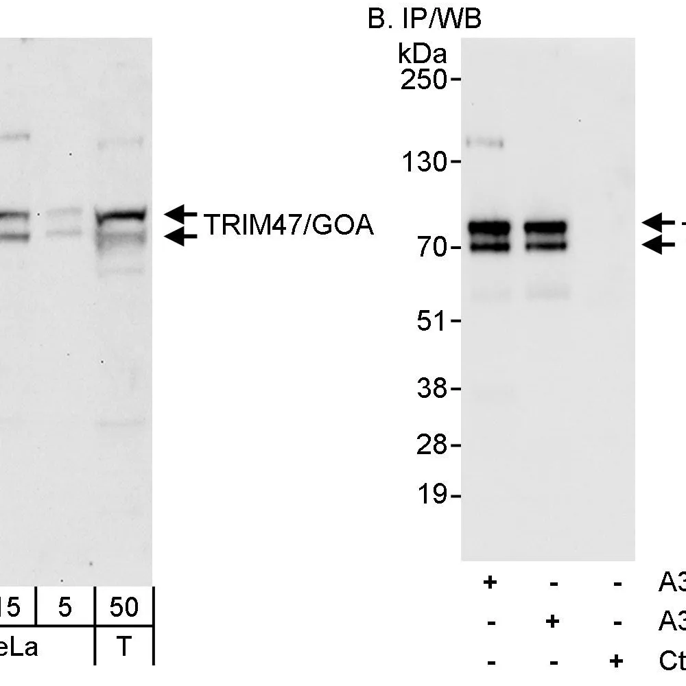Rabbit anti-TRIM47/GOA Antibody, Affinity Purified