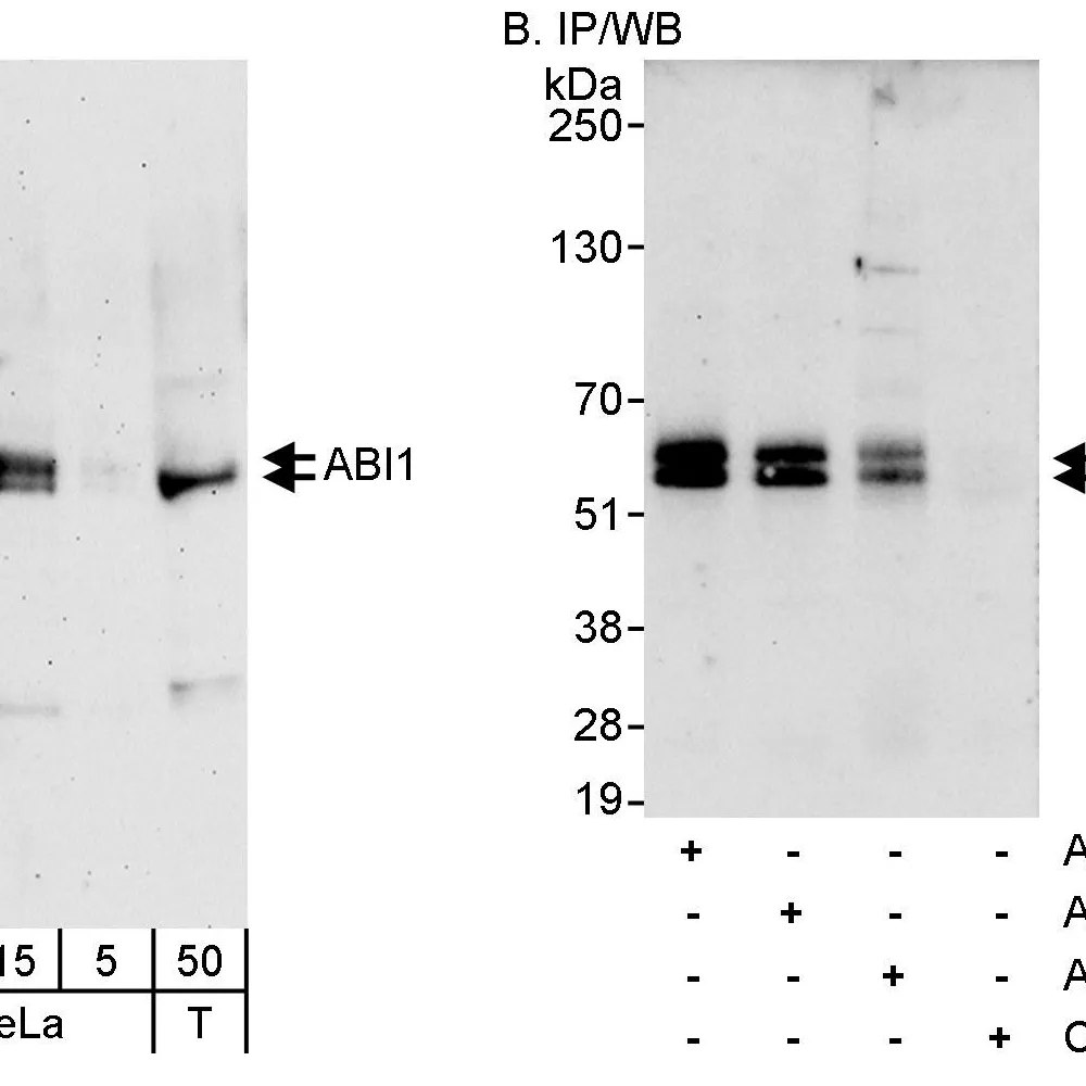 Rabbit anti-ABI1 Antibody, Affinity Purified