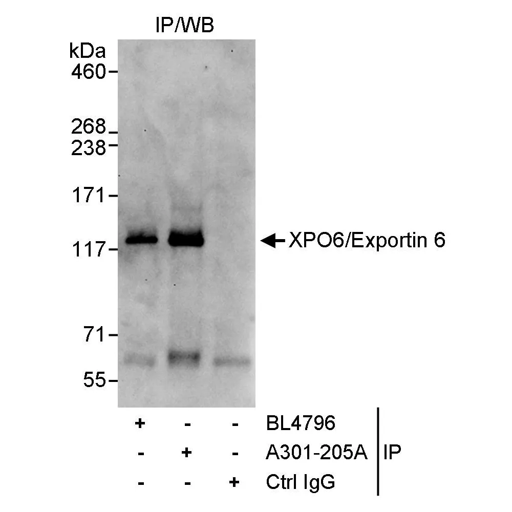 Rabbit anti-XPO6/Exportin 6 Antibody, Affinity Purified