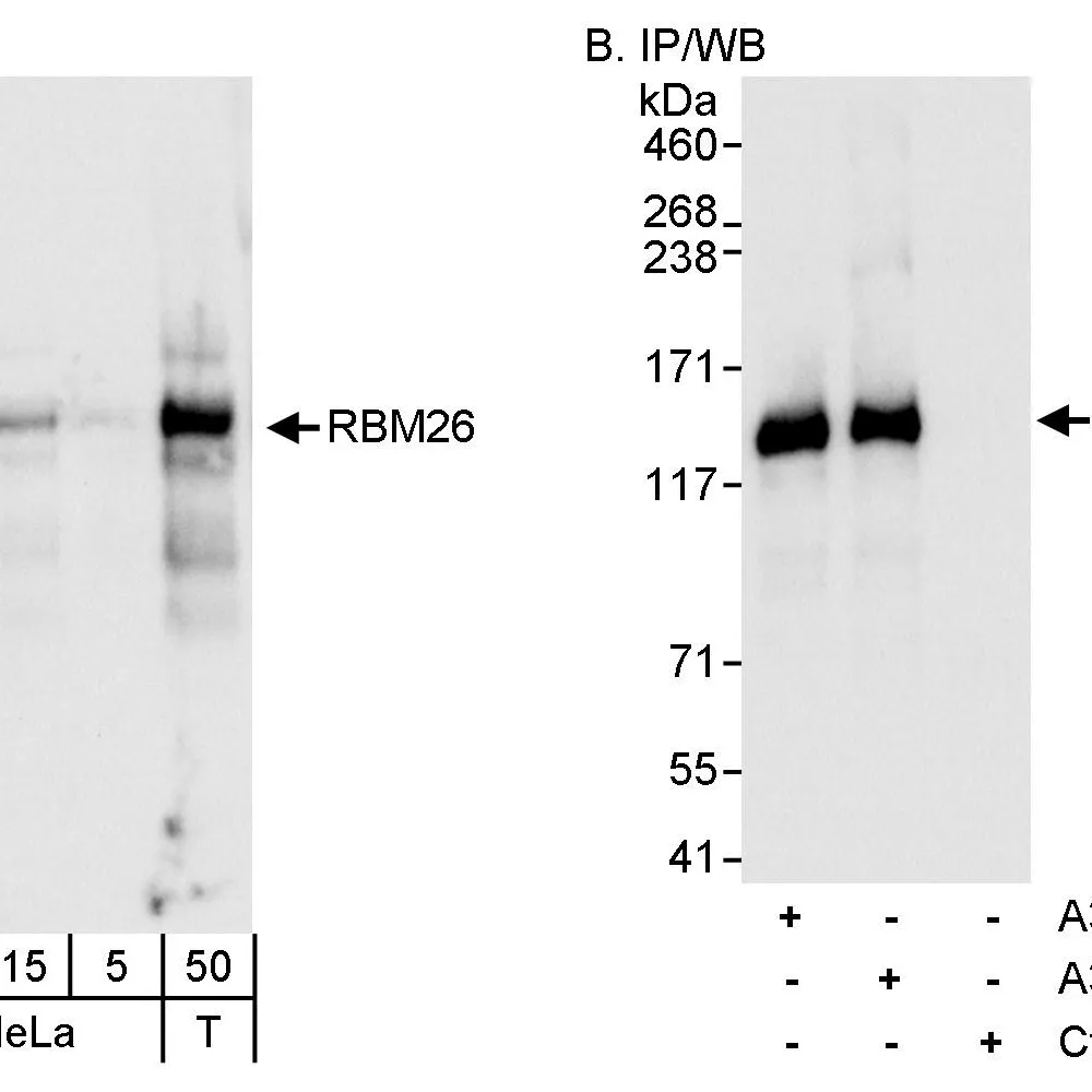 Rabbit anti-RBM26 Antibody, Affinity Purified