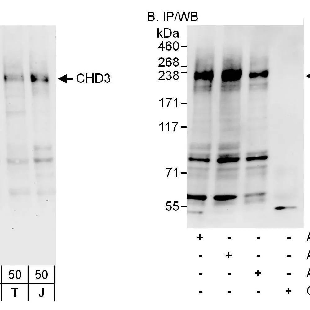 Rabbit anti-CHD3 Antibody, Affinity Purified
