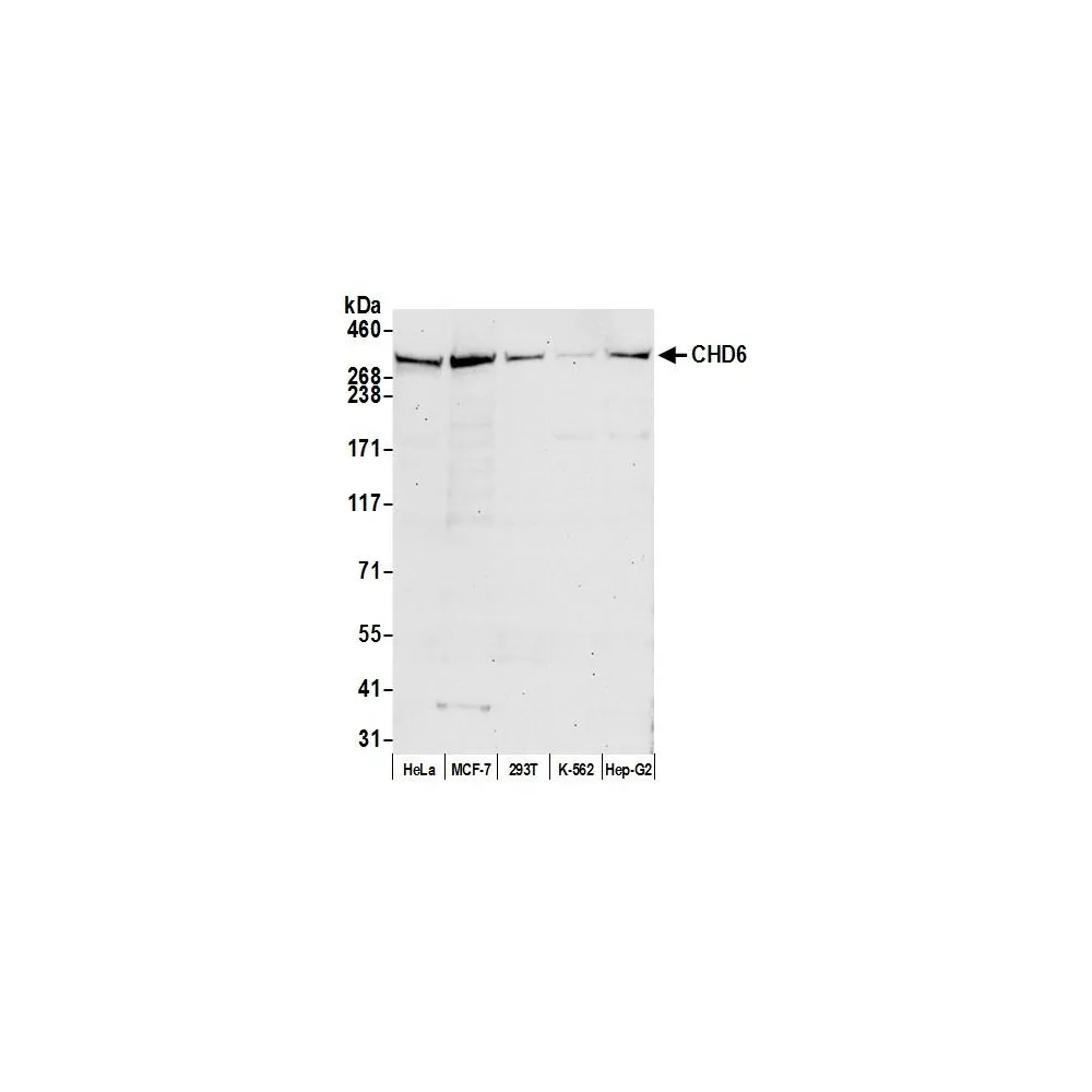 Rabbit anti-CHD6 Antibody, Affinity Purified