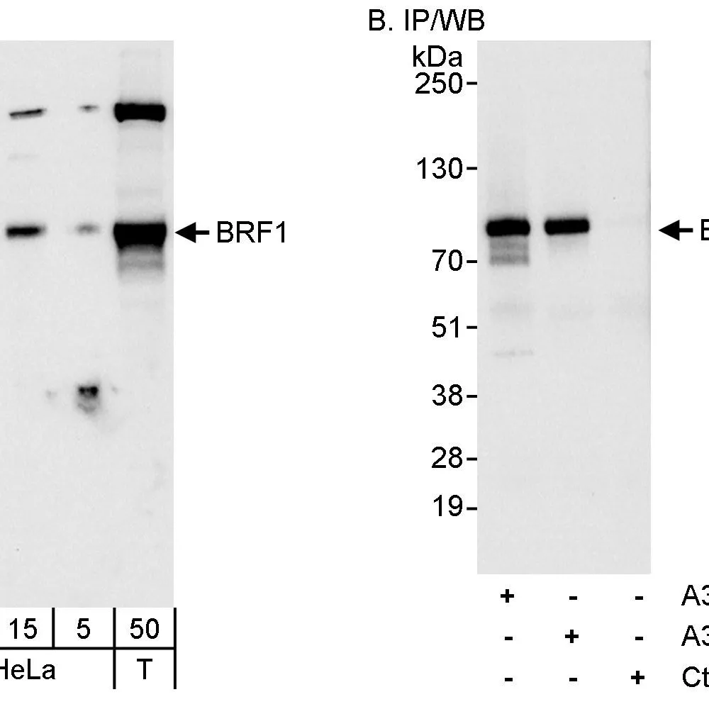 Rabbit anti-BRF1 Antibody, Affinity Purified