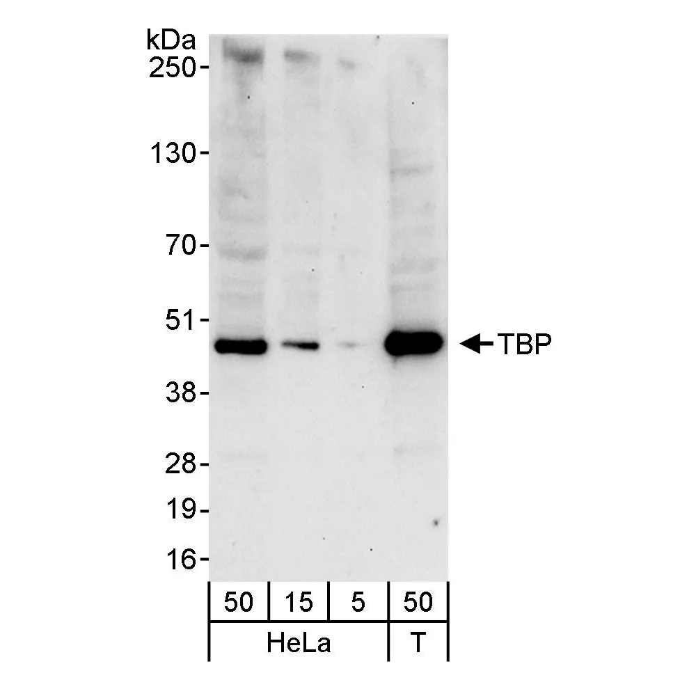Rabbit anti-TBP Antibody, Affinity Purified