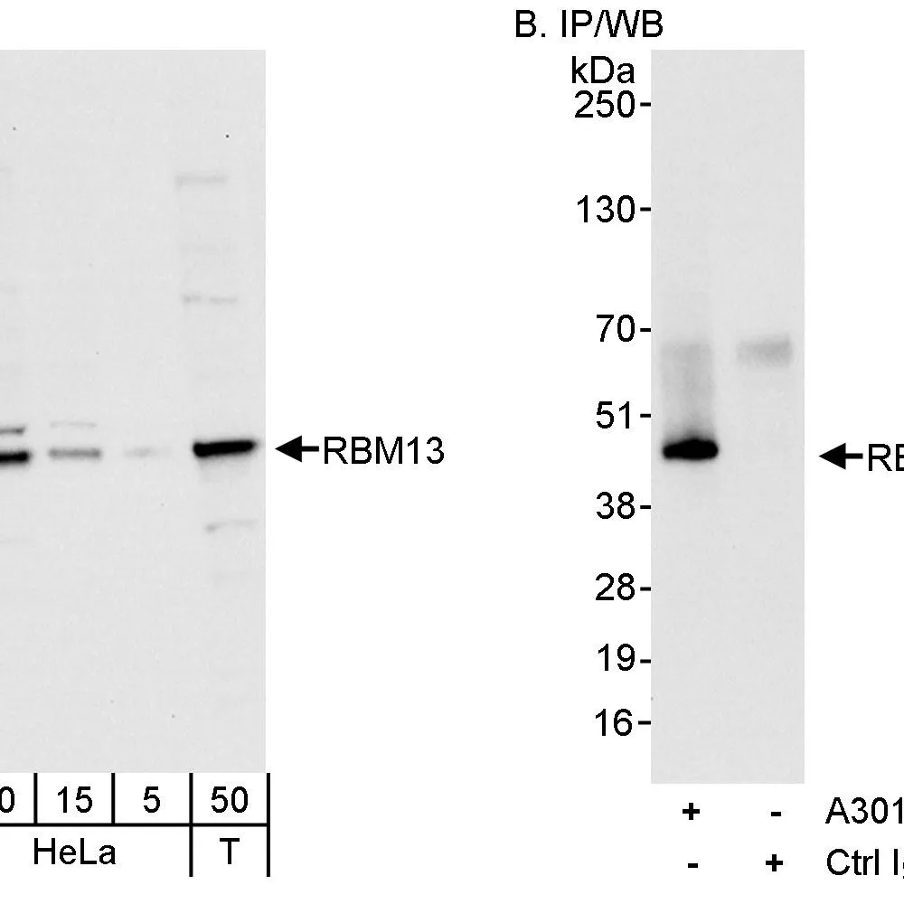 Rabbit anti-RBM13 Antibody, Affinity Purified
