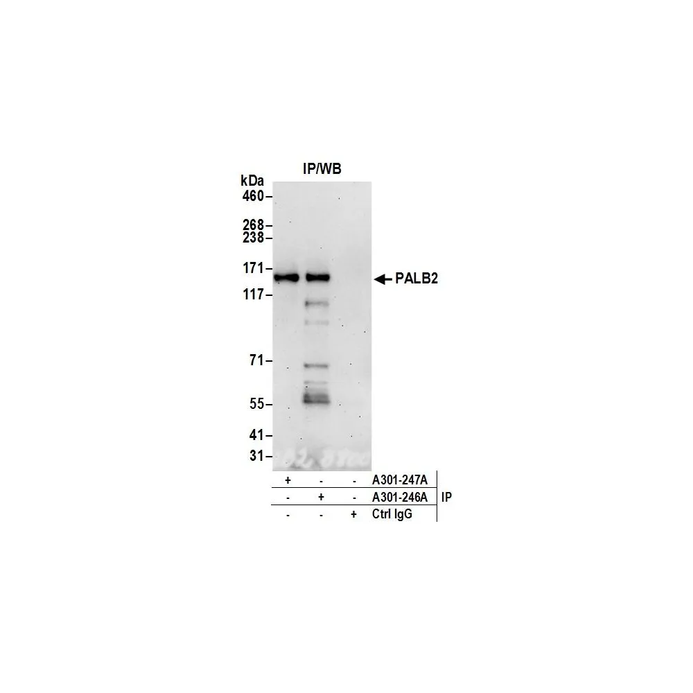 Rabbit anti-PALB2 Antibody, Affinity Purified