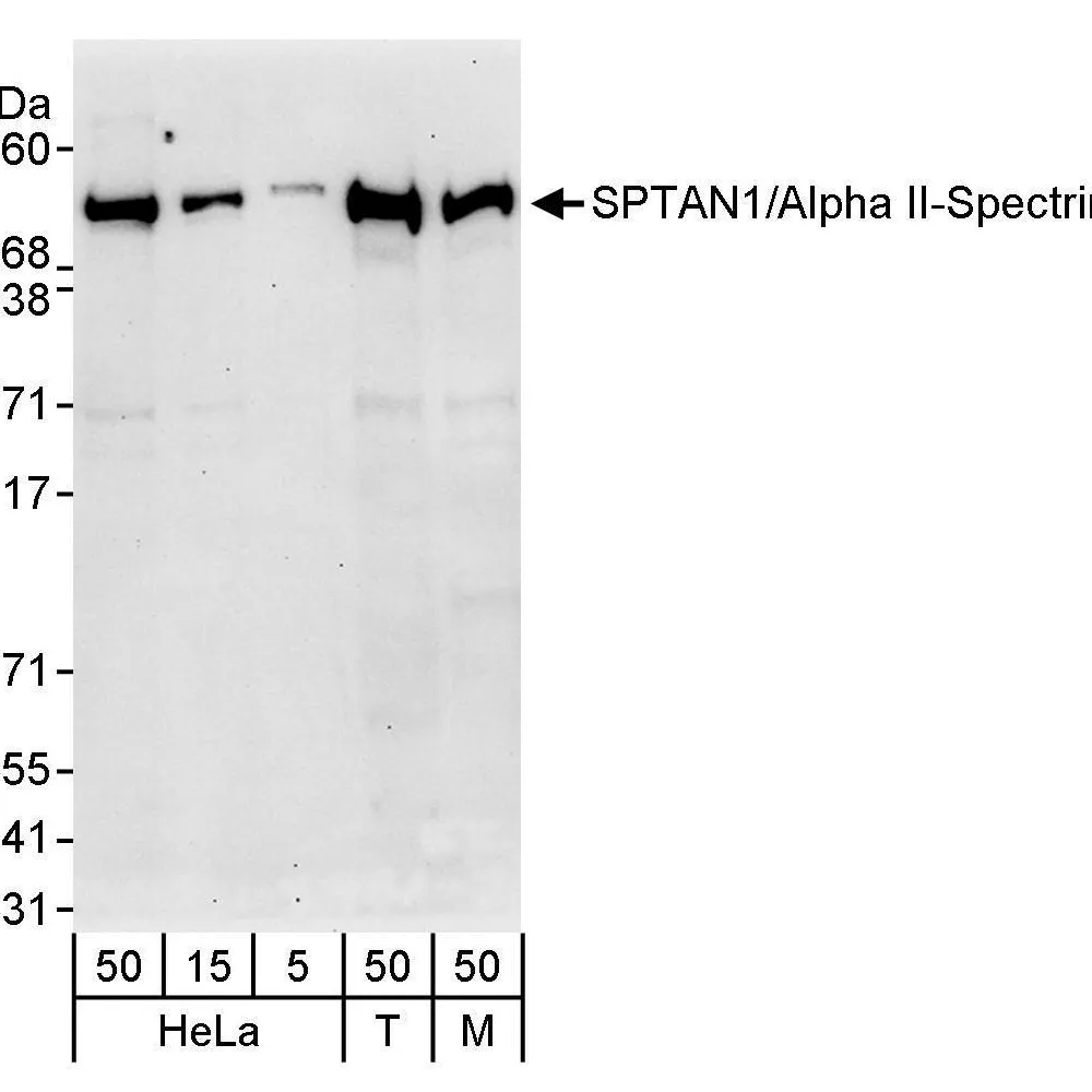 Rabbit anti-SPTAN1/Alpha II-spectrin Antibody, Affinity Purified