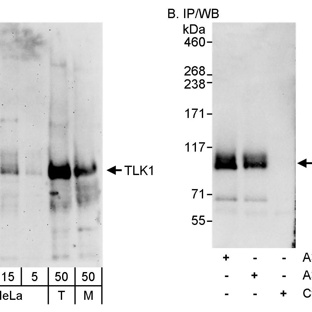 Rabbit anti-TLK1 Antibody, Affinity Purified