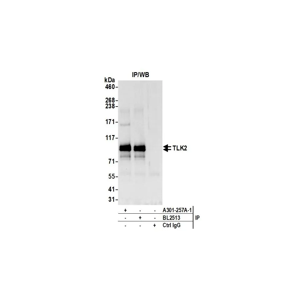 Rabbit anti-TLK2 Antibody, Affinity Purified