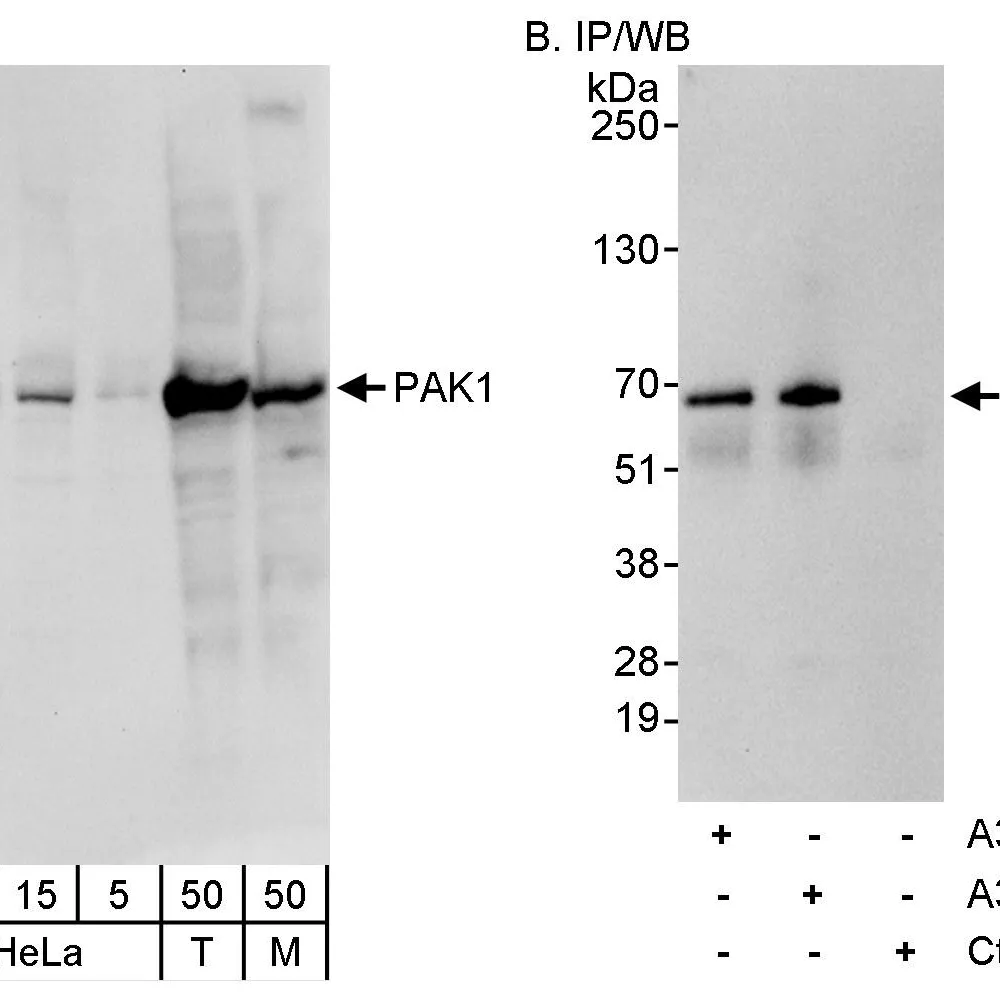 Rabbit anti-PAK1 Antibody, Affinity Purified