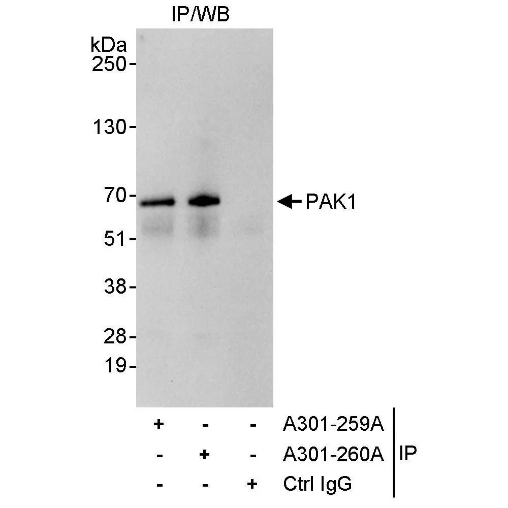 Rabbit anti-PAK1 Antibody, Affinity Purified