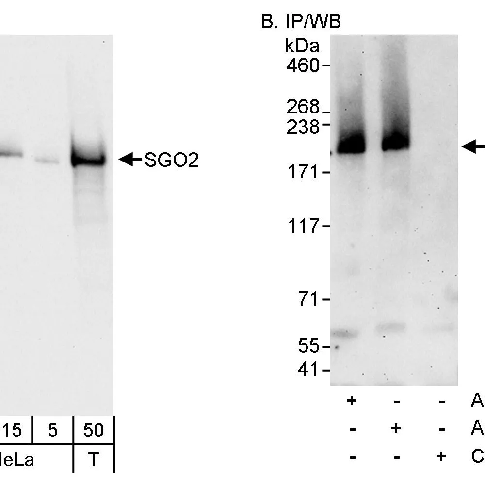 Rabbit anti-SGO2 Antibody, Affinity Purified