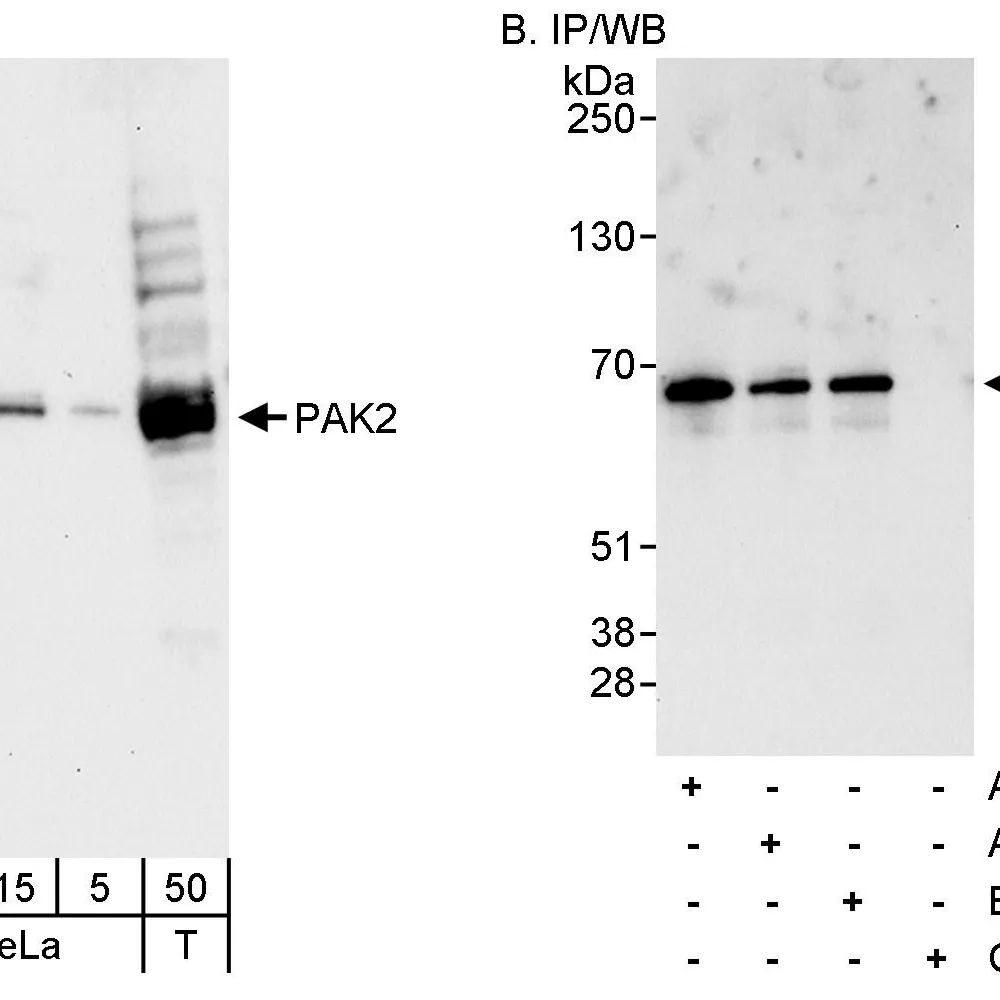 Rabbit anti-PAK2 Antibody, Affinity Purified