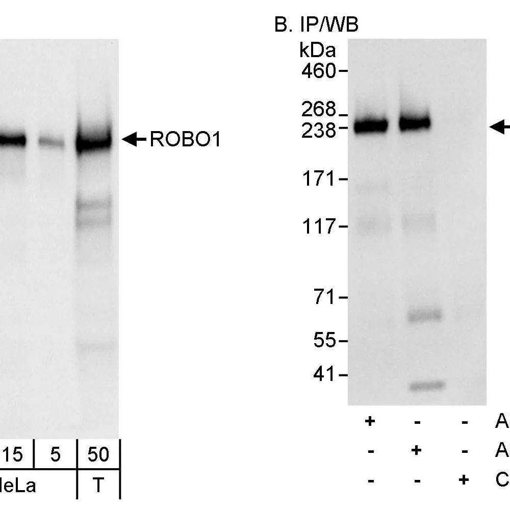 Rabbit anti-ROBO1 Antibody, Affinity Purified