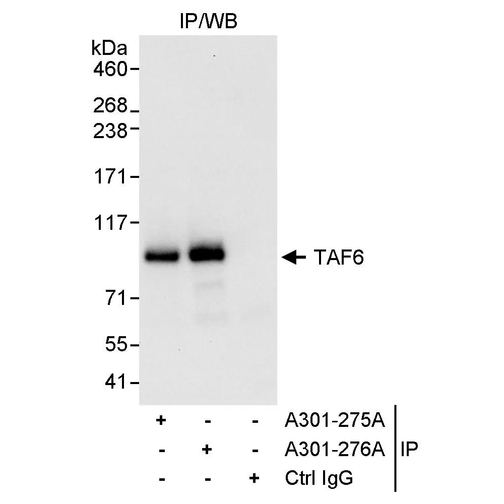 Rabbit anti-TAF6 Antibody, Affinity Purified