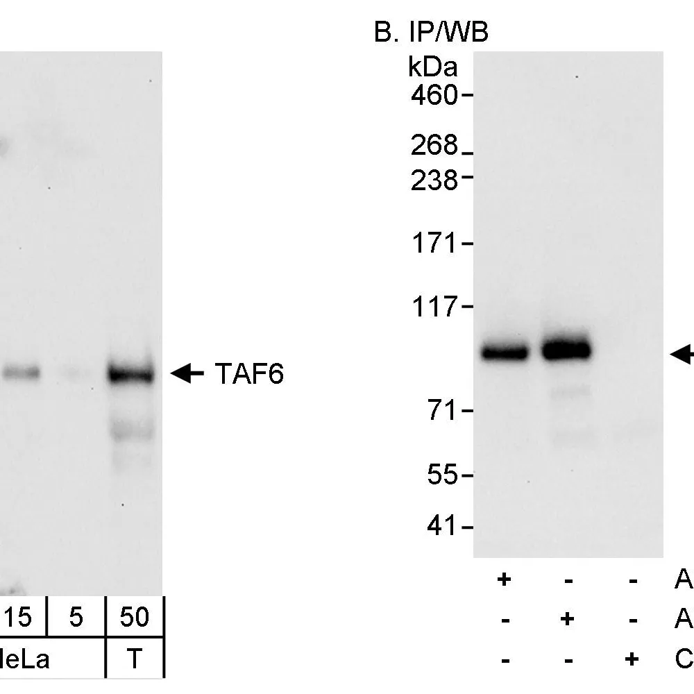 Rabbit anti-TAF6 Antibody, Affinity Purified
