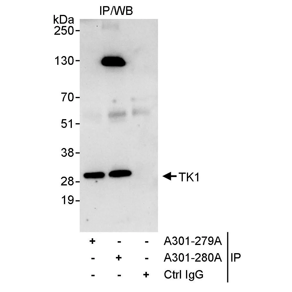 Rabbit anti-TK1 Antibody, Affinity Purified