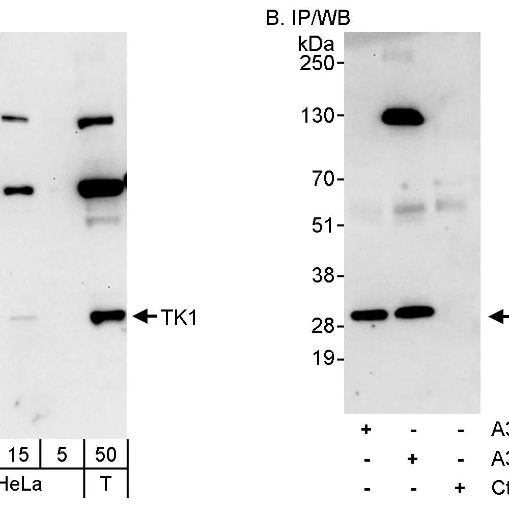 Rabbit anti-TK1 Antibody, Affinity Purified
