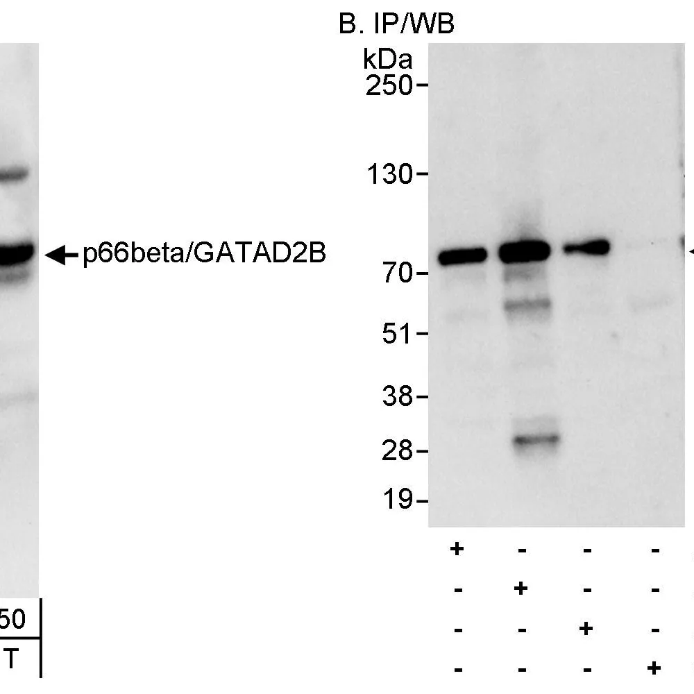 Rabbit anti-p66beta/GATAD2B Antibody, Affinity Purified