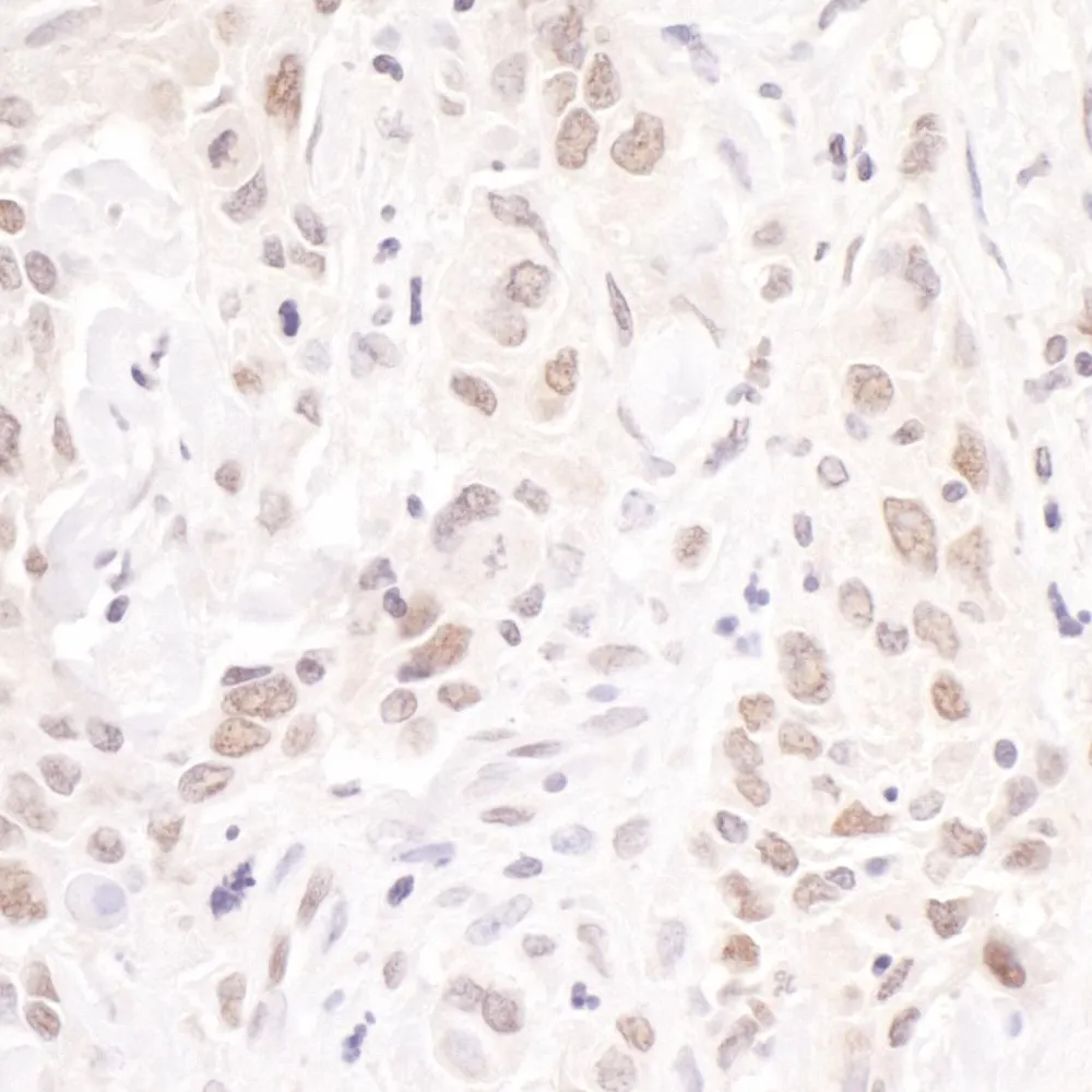 Rabbit anti-p66beta/GATAD2B Antibody, Affinity Purified