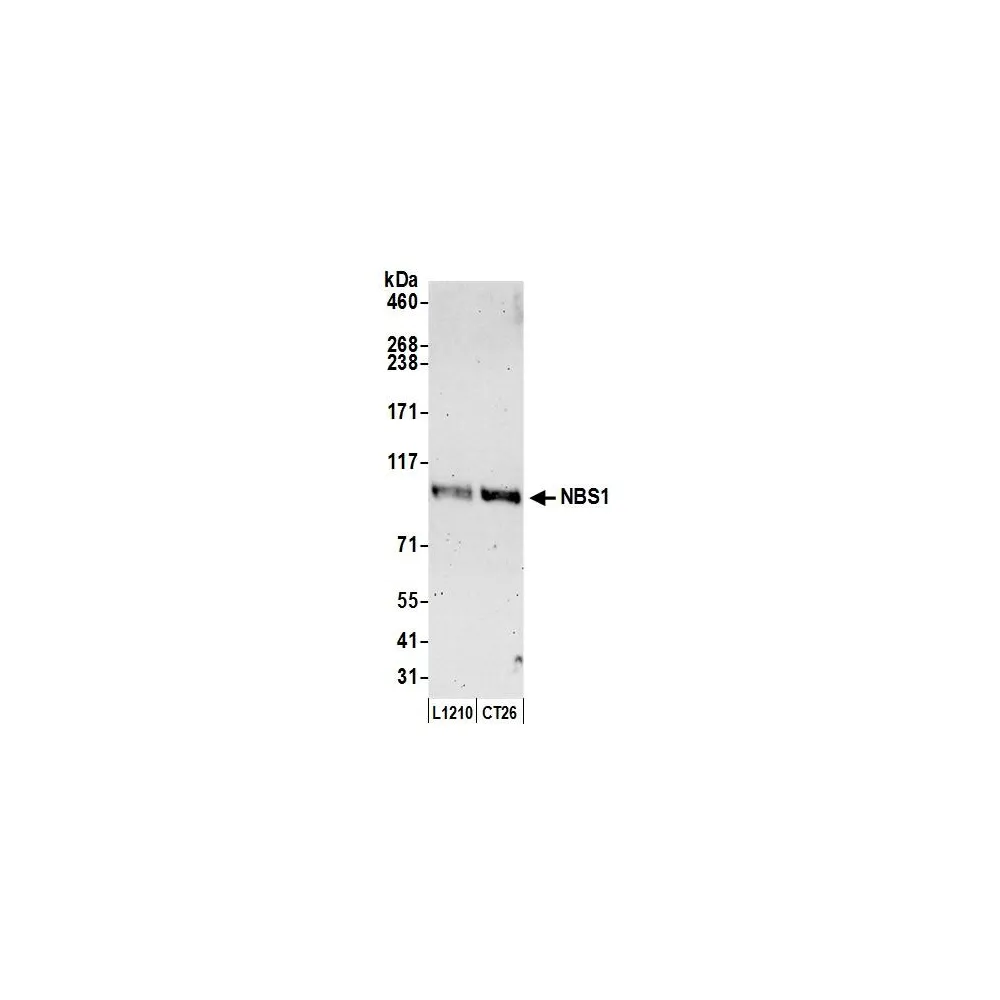 Rabbit anti-NBS1 Antibody, Affinity Purified