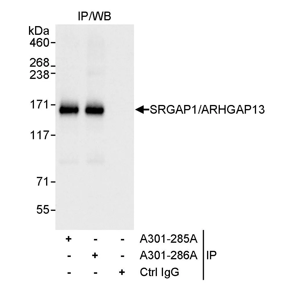Rabbit anti-SRGAP1/ARHGAP13 Antibody, Affinity Purified
