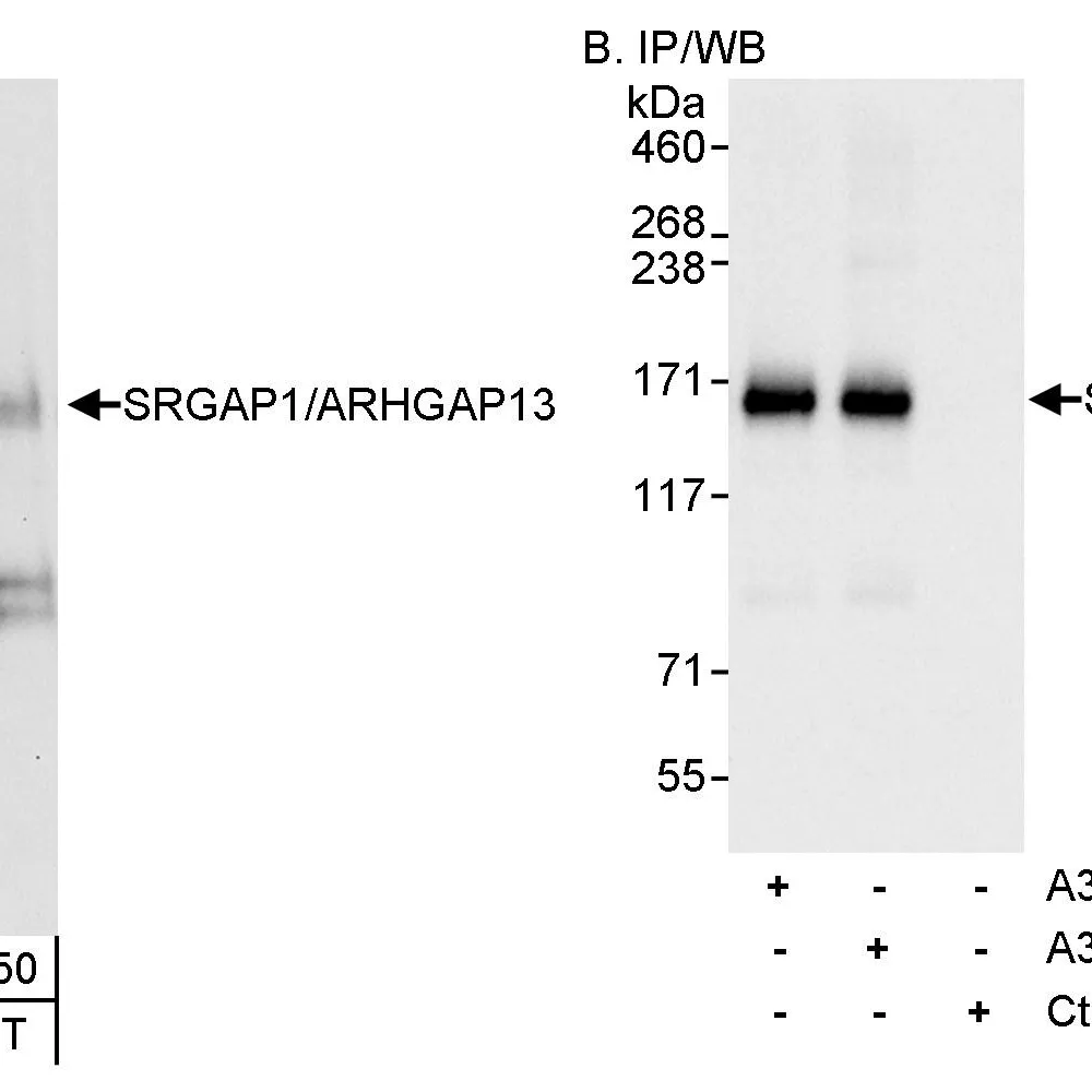 Rabbit anti-SRGAP1/ARHGAP13 Antibody, Affinity Purified