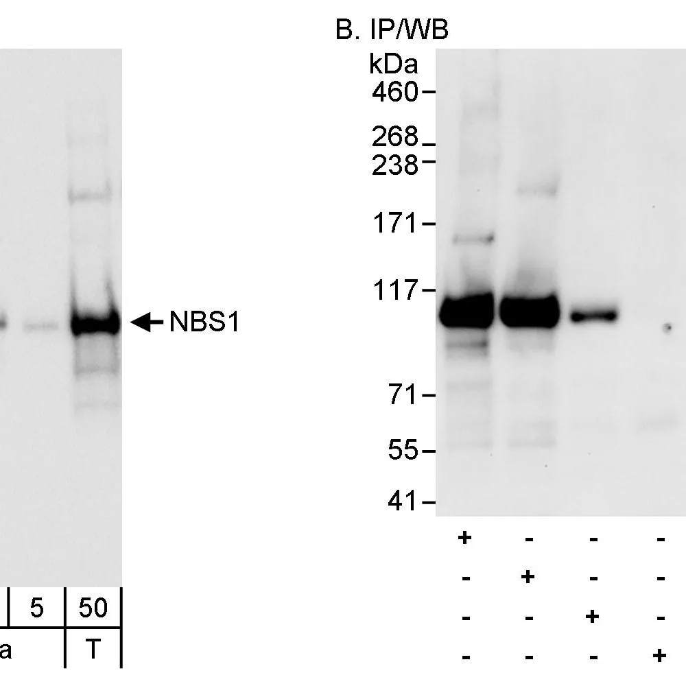 Rabbit anti-NBS1 Antibody, Affinity Purified