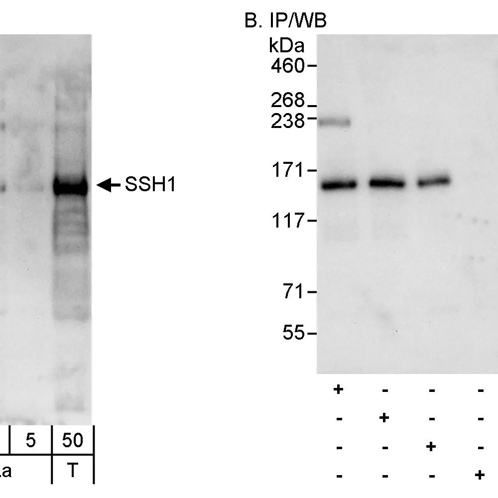 Rabbit anti-SSH1 Antibody, Affinity Purified