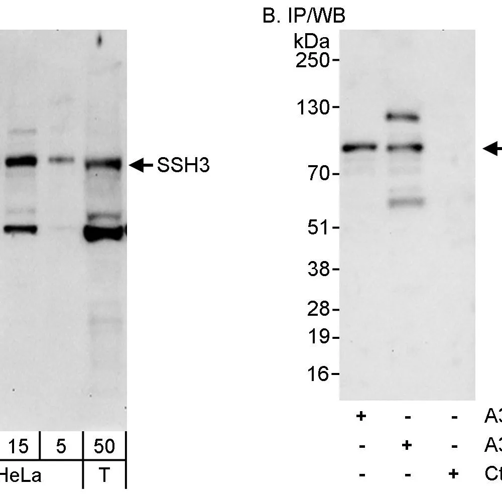 Rabbit anti-SSH3 Antibody, Affinity Purified