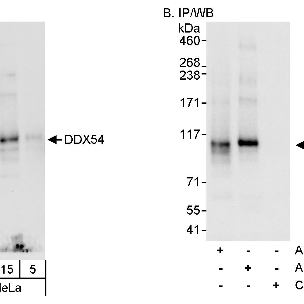 Rabbit anti-DDX54 Antibody, Affinity Purified